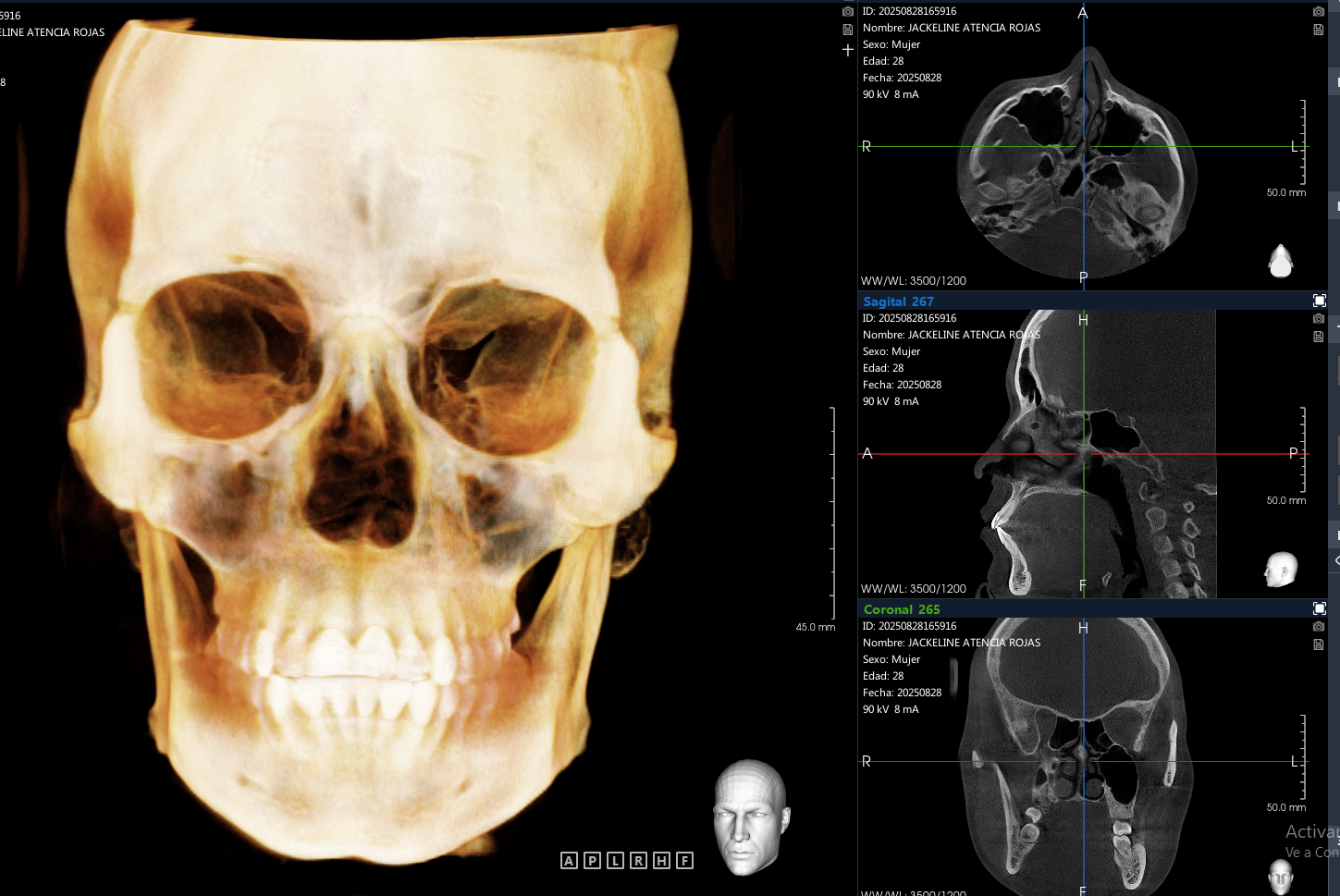 maxilofacial